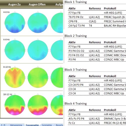 Whole-Brain Training