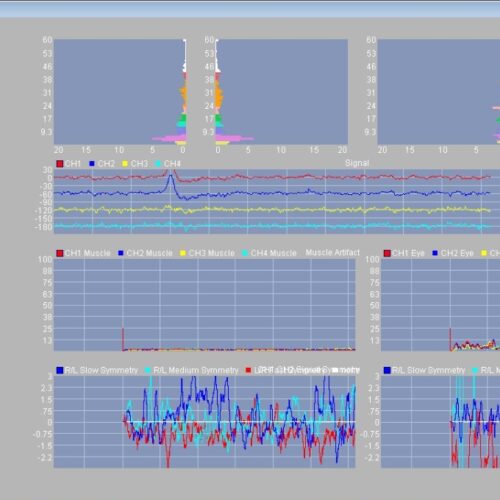 hole-Brain Training for BioEra (EU)